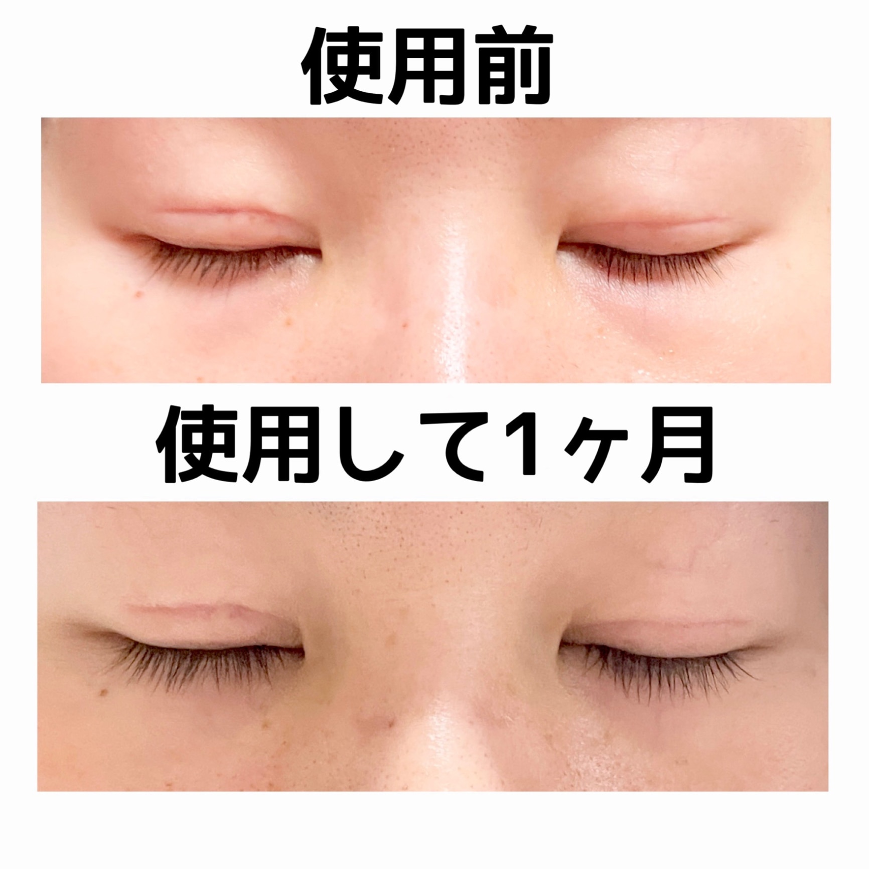スカルプD アイラッシュセラム ピュア |スカルプD まつげ美容液