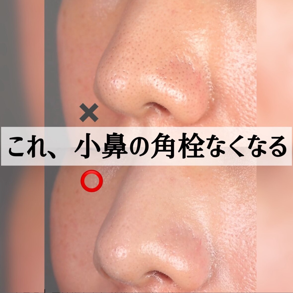ilso ( イルソ ) 公式 】【 ナチュラルマイルドノーズパック(5枚入) 】 鼻パック 角栓パック 角栓取り 皮脂 毛穴ケア ブラック ...