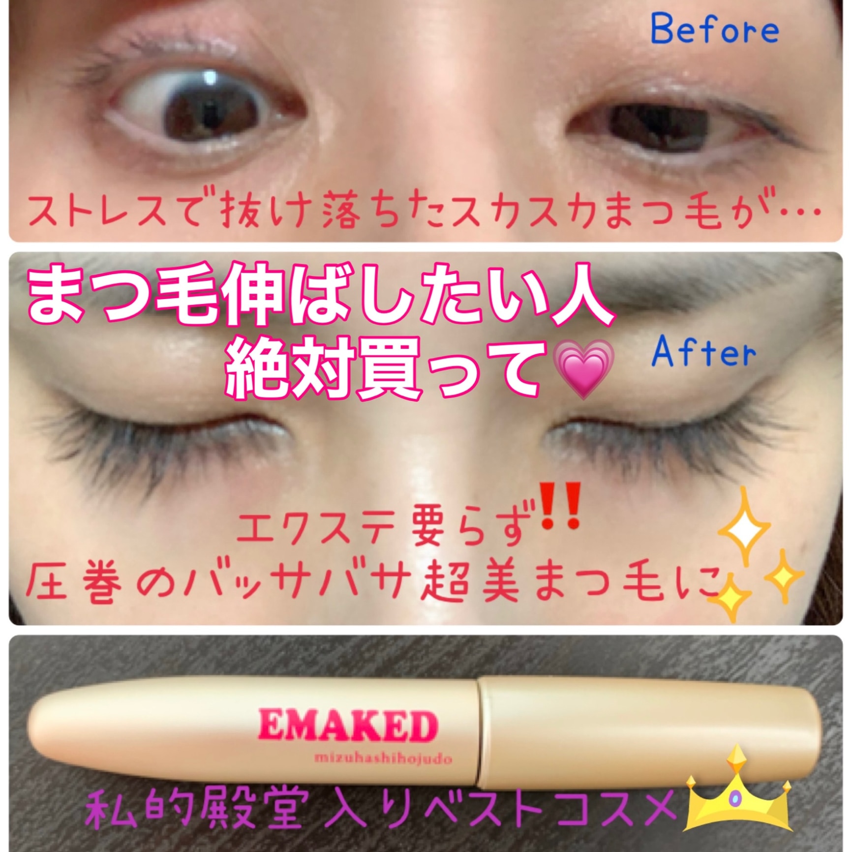 海外限定】 ☆新品未使用☆エマーキット3本セット まつげ美容液 2ml